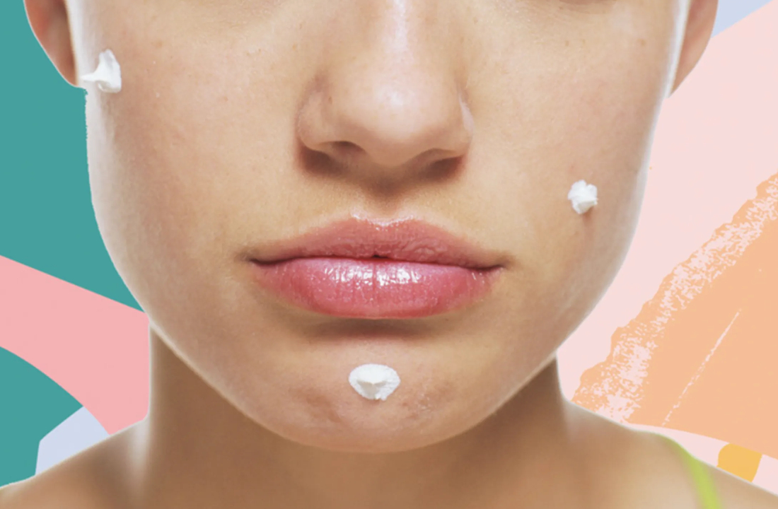 Acne Care Basics All You Need To Know Rate My Choice